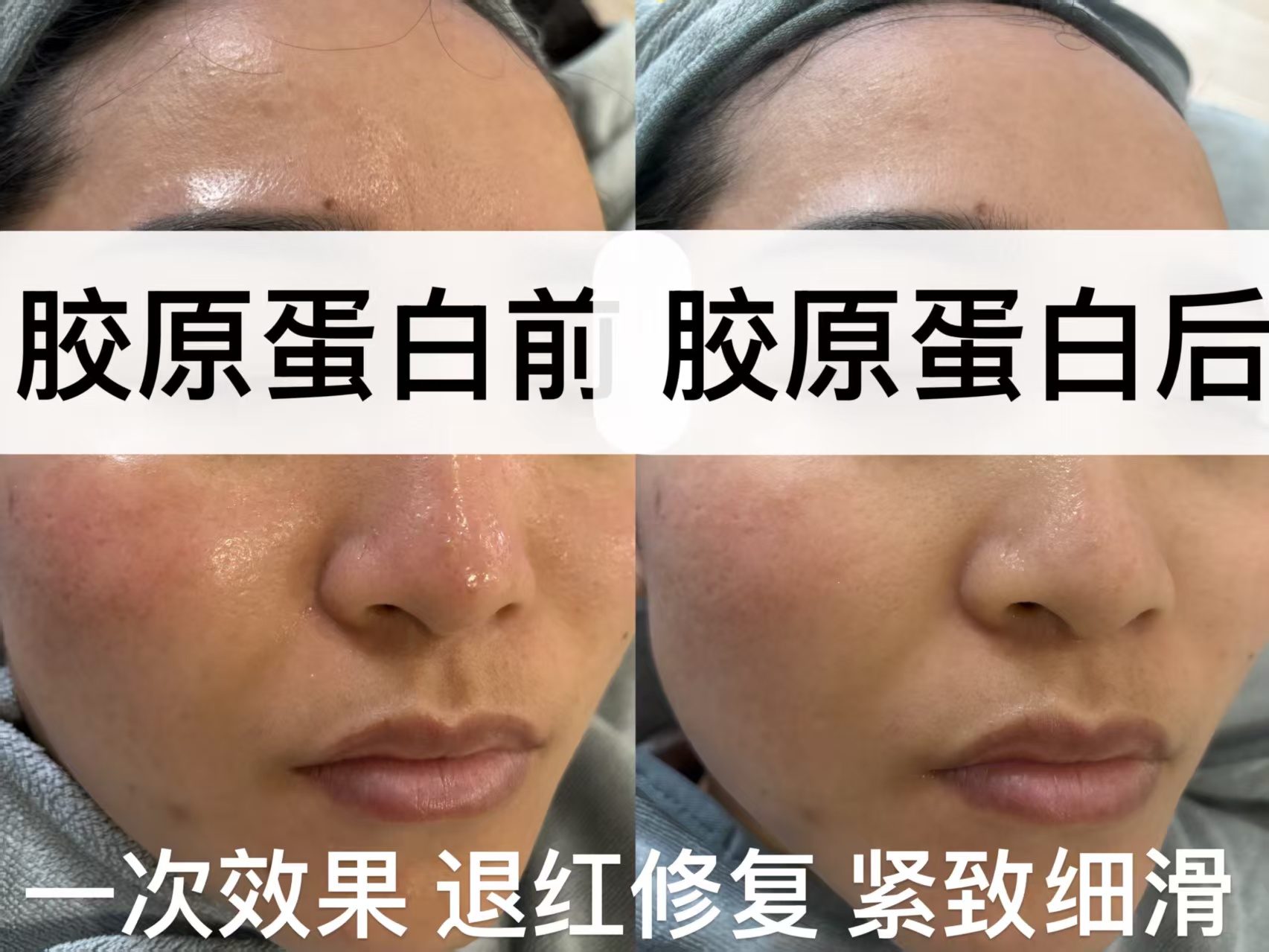 妈生皮胶原养护护理记录示意