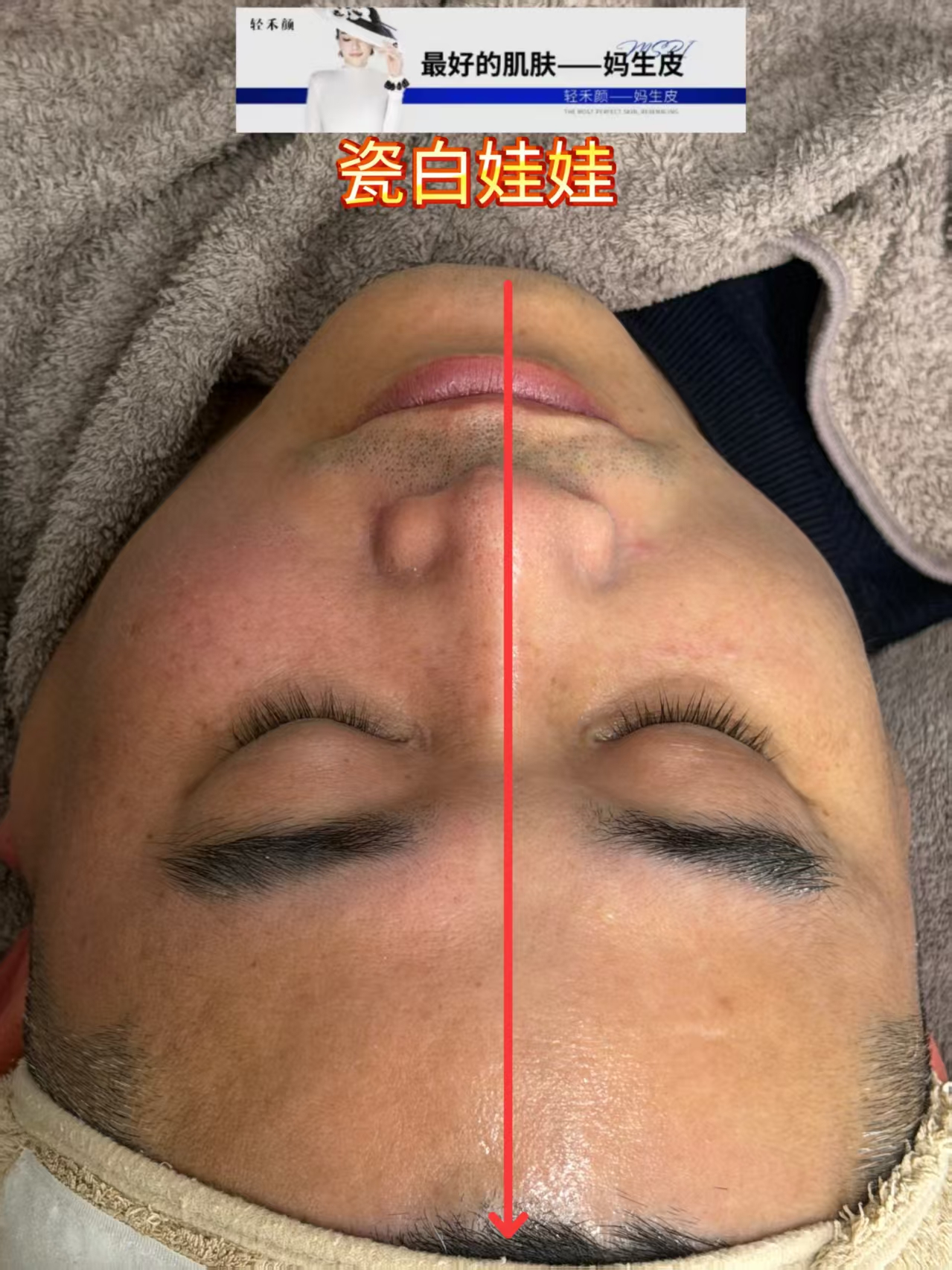 妈生皮瓷白娃娃护理记录示意